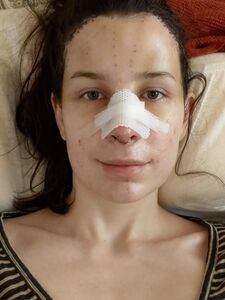 Aella Girl new hot onlyfans leaked nudes