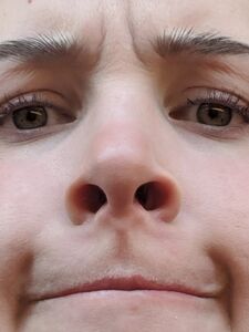 Aella Girl new hot onlyfans leaked nudes